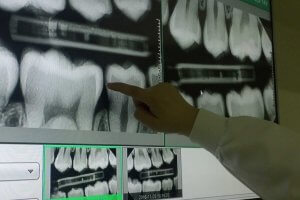 Dental X-Ray Video