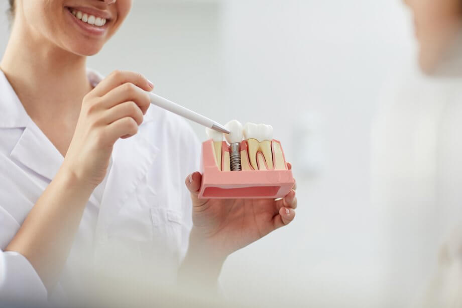 How Do Dental Implants Work?